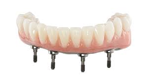 fined-dentures treatment ahmedabad